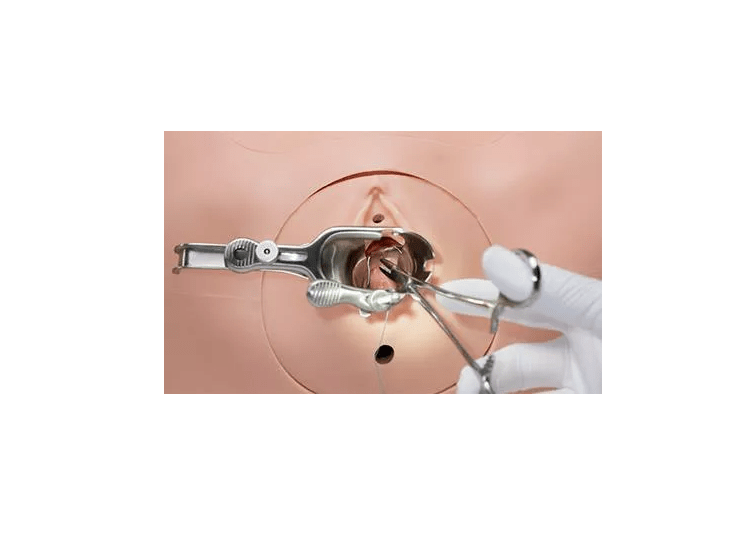 Vulva mit intergrierter Fistel für R10188 - Erler - Zimmer